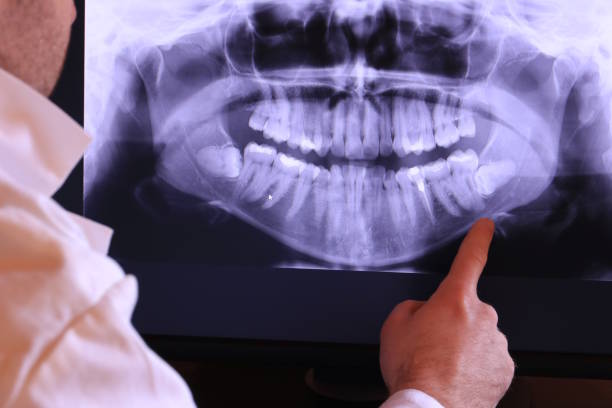 Best Emergency Dental Surgery in Barry, IL
