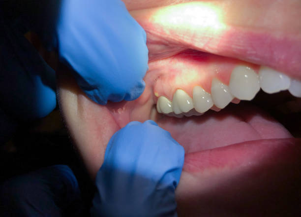 Best Pediatric Emergency Dentist in Barry, IL