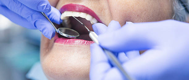 Best Emergency Root Canal Treatment in Barry, IL